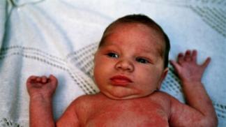Hautausschlag am Körper eines Babys - Arten, Ursachen und Merkmale